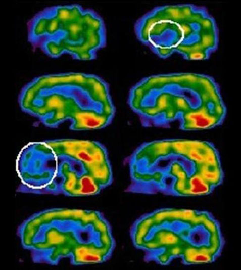 Scan of variation in thermal activity in the human brain.