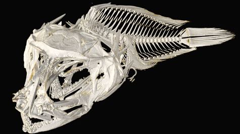 CAT scan :