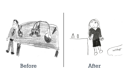 Before and after