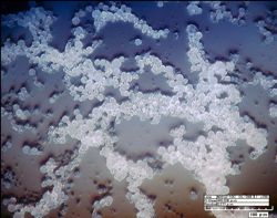 A photomicrograph of PHA microbeads created at VIMS. Scale is in microns (millionths of a meter). Photo courtesy of Jason McDevitt, Applied Research Center.